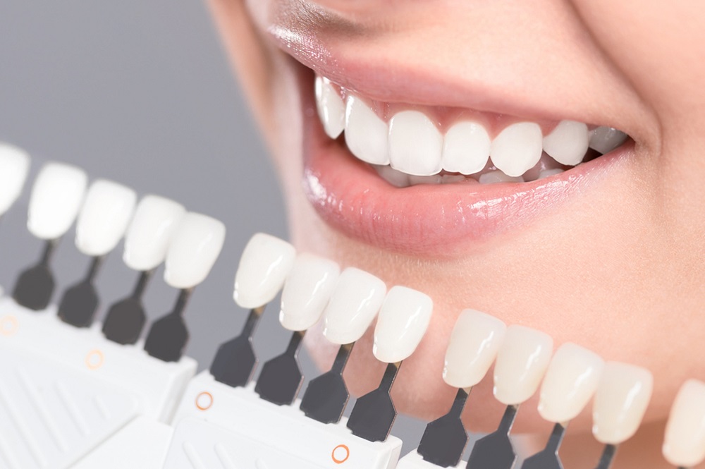 Quick tips regarding teeth whitening