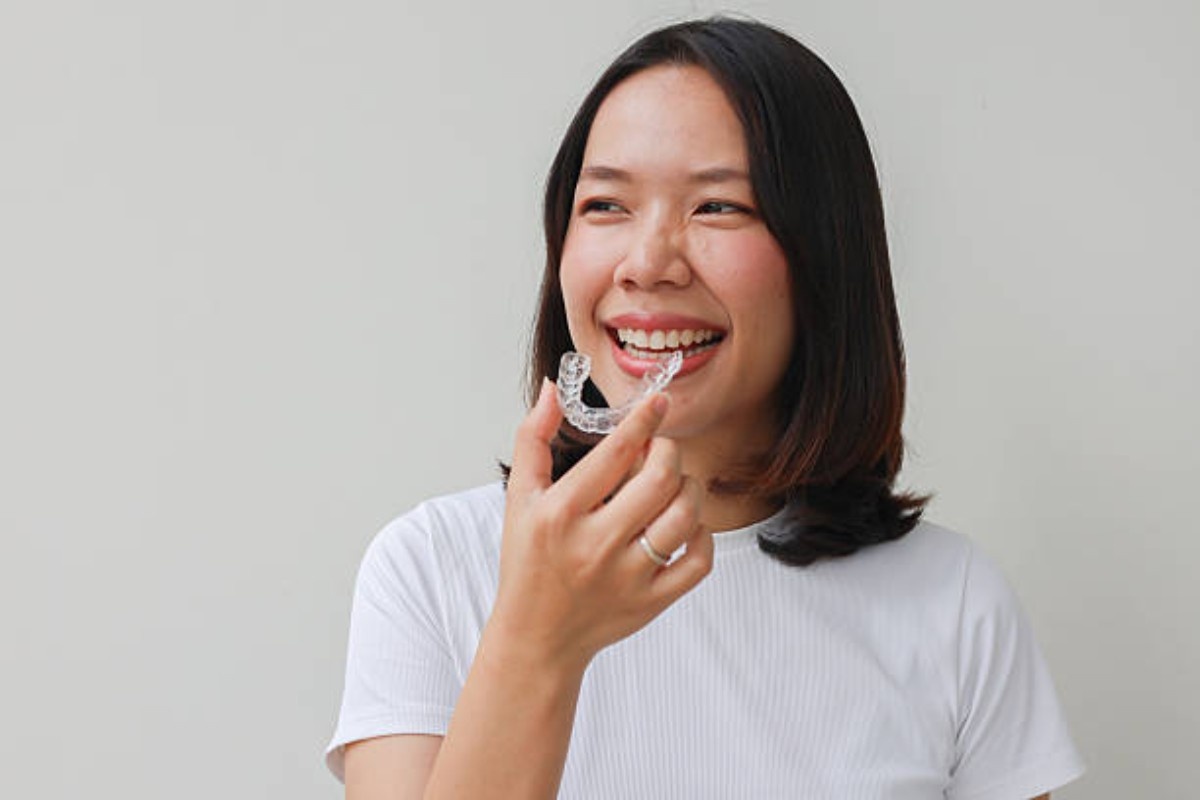 what is the 30 minute rule with invisalign